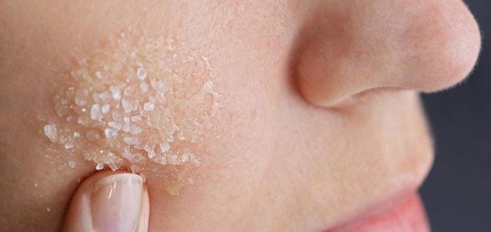 Πόροι στο πρόσωπο