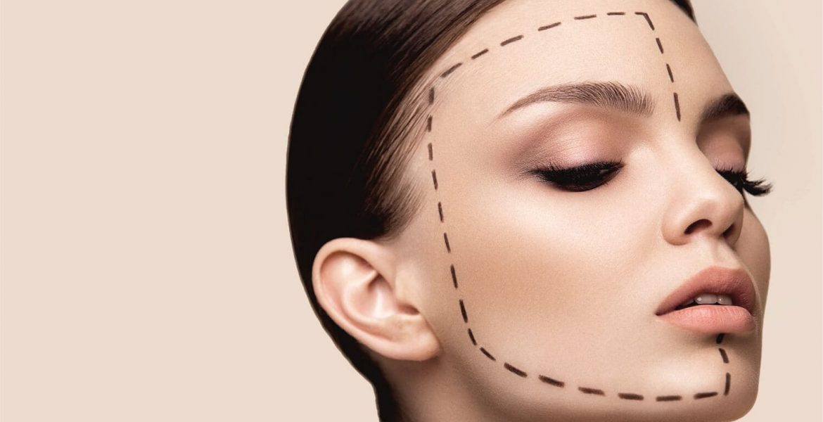 Lifting προσώπου με νήματα