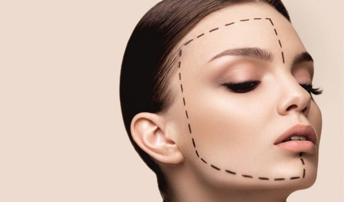 Lifting προσώπου με νήματα